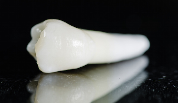 Extractions at Artistic Touch Dentistry